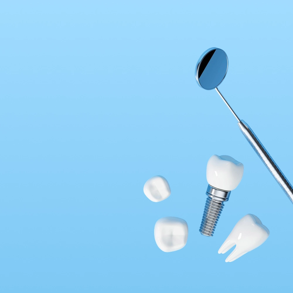 https://defeys.com/wp-content/uploads/2025/05/implant-3.webp