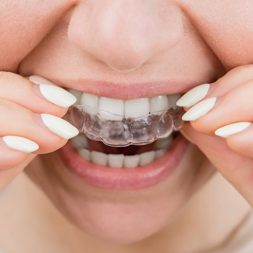 https://defeys.com/wp-content/uploads/2025/05/invisalign-1.webp