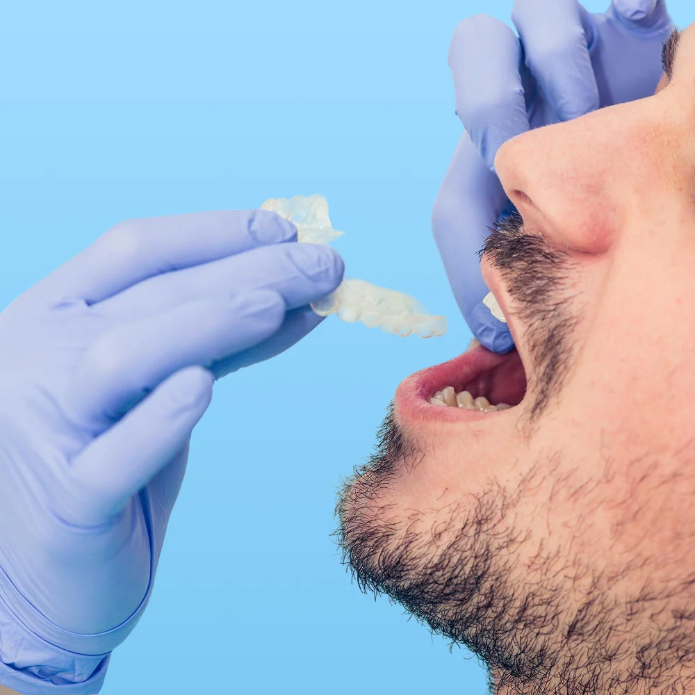 https://defeys.com/wp-content/uploads/2025/05/invisalign-3.webp