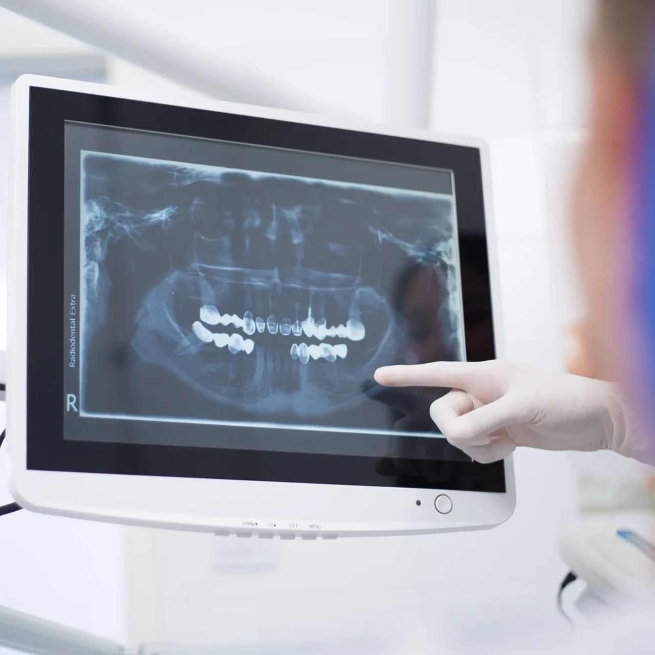 https://defeys.com/wp-content/uploads/2025/05/x-rays-3-1280x1280.webp